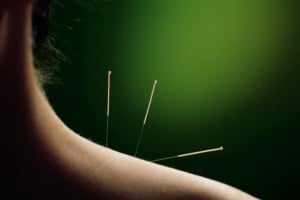 Talk To Your Patients About Acupuncture