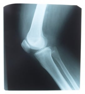 Talk to Your Patients About Joint Health