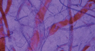 Cardiovascular