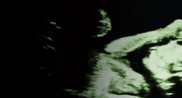 Prenatal